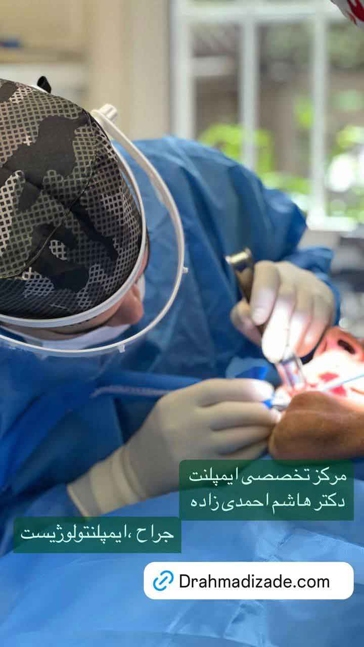 مزیت ایمپلنت - دکتر امدی زاده جراح و ایمپلنتولوژیست