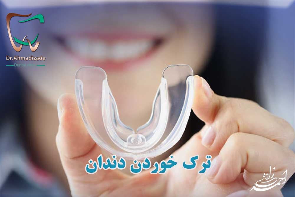 ترک خوردن دندان
