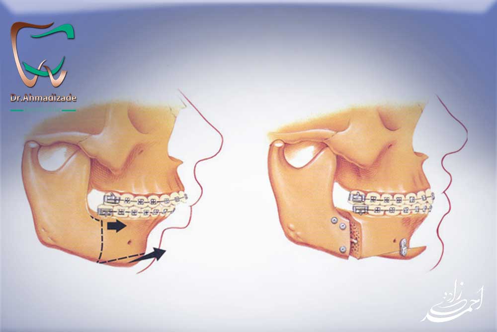 Maxillofacial surgery6