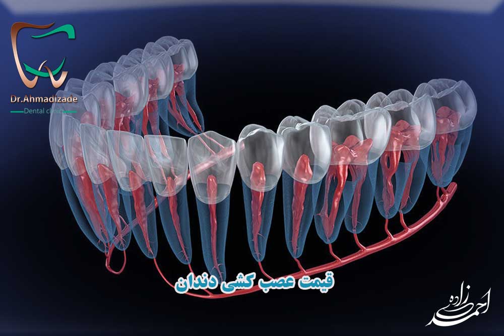 قیمت عصب کشی دندان