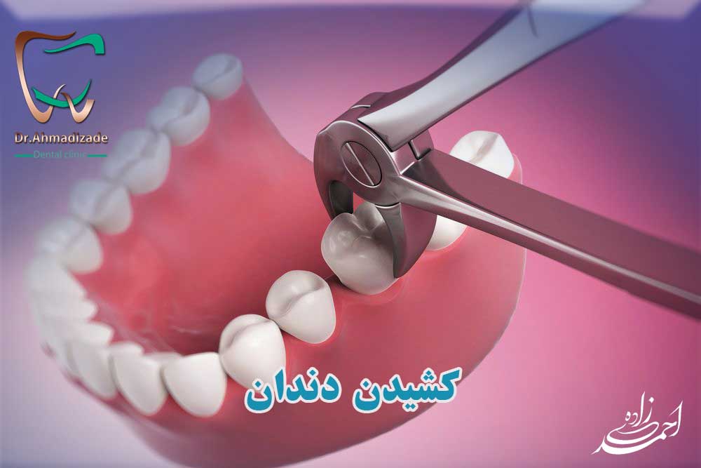 tooth