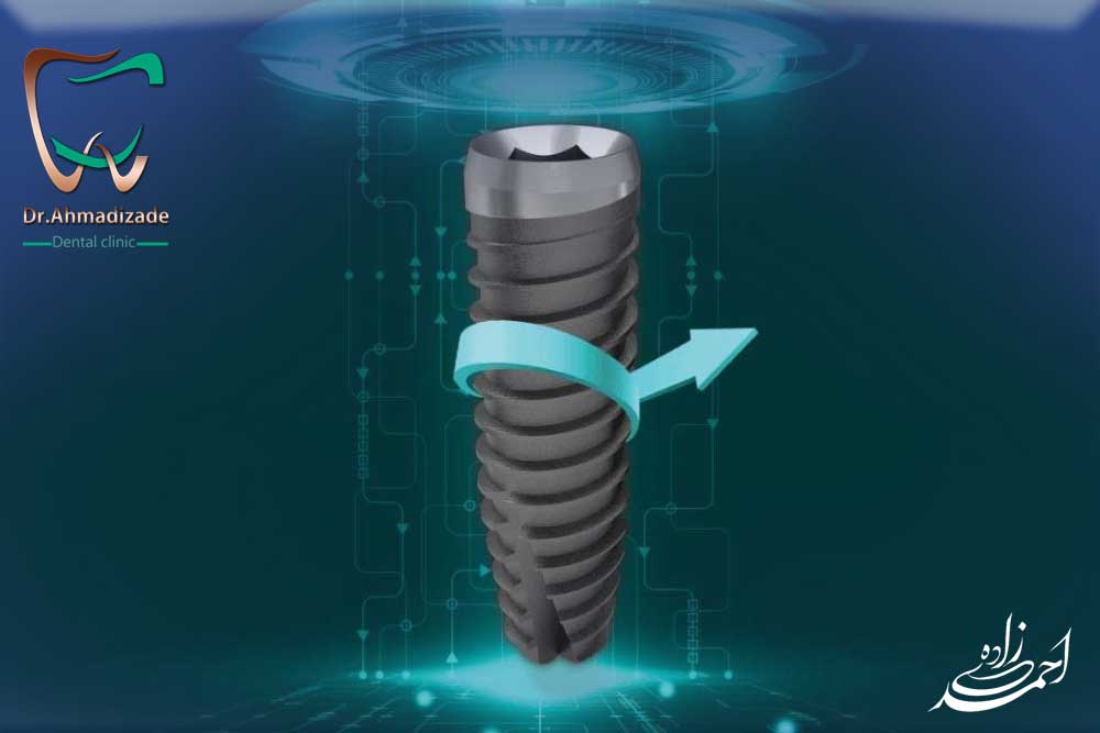SNUCONE implant2