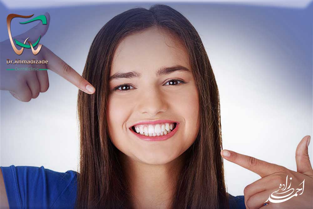 sen veneer3